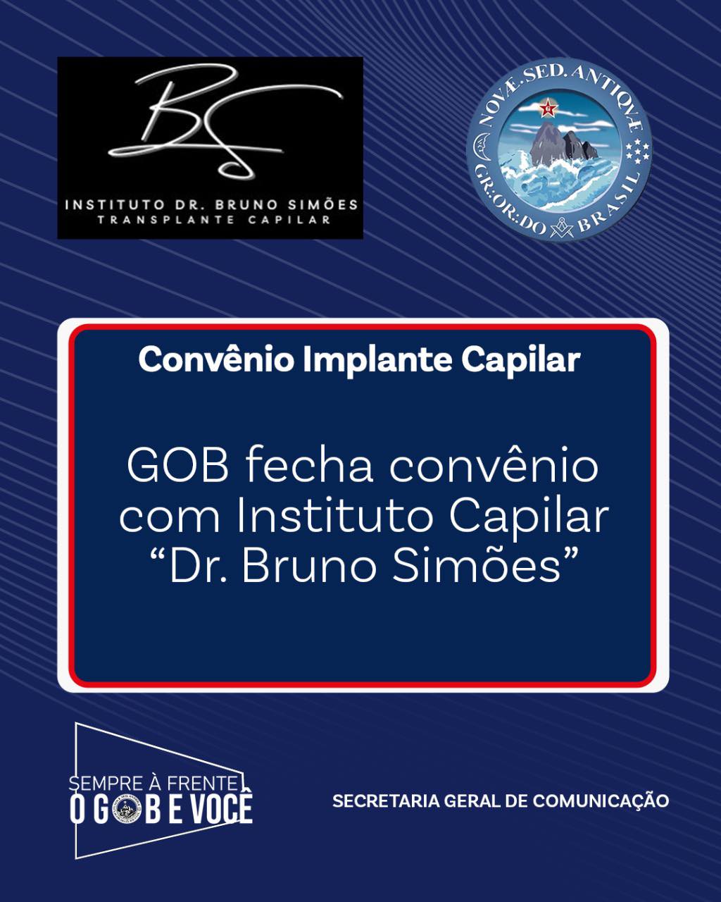 Transplante Capilar